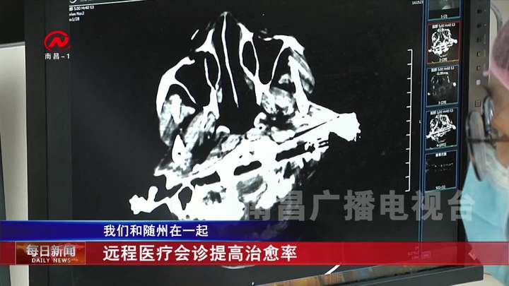 远程医疗会诊提高治愈率