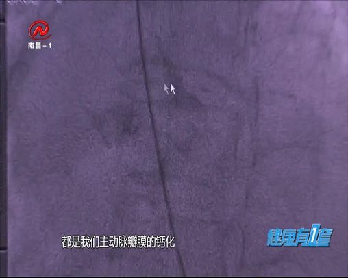 健康有一套 2020-05-27