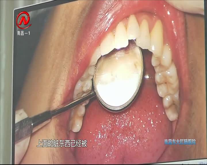 健康有一套 2021-03-19