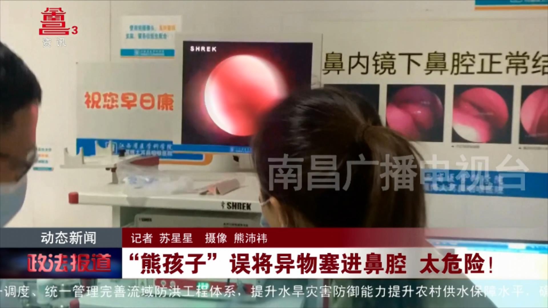 “熊孩子”误将异物塞进鼻腔 太危险！